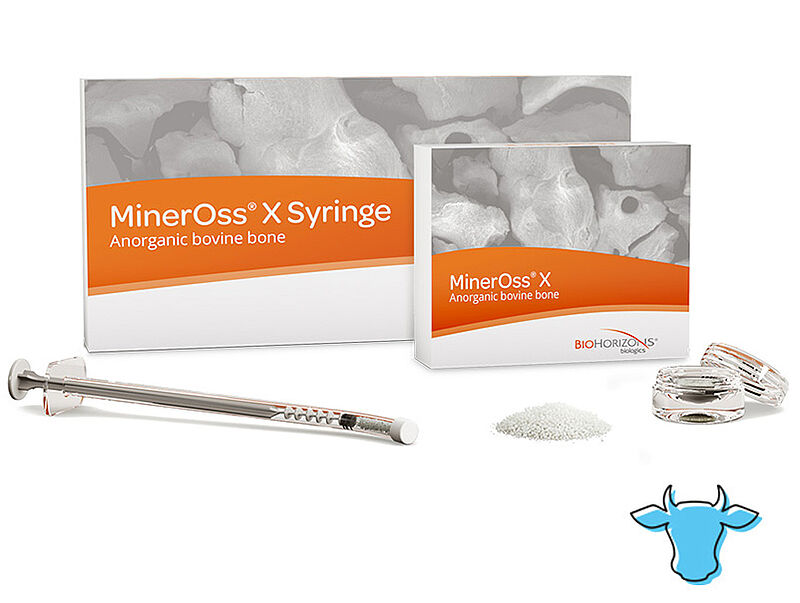 MinerOss X Materiał kościozastępczy pochodzenia wołowego MinerOss X to nieorganiczna macierz mineralna kości pochodzenia wołowego, która jest porównywalna do struktury mineralnej ludzkiej tkanki kostnej.