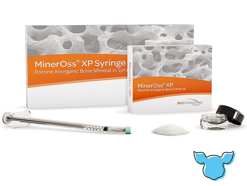 MinerOss XP Materiał kościozastępczy pochodzenia wieprzowego MinerOss XP to nieorganiczna wieprzowa macierz mineralna przeznaczona do przeszczepów kostnych.